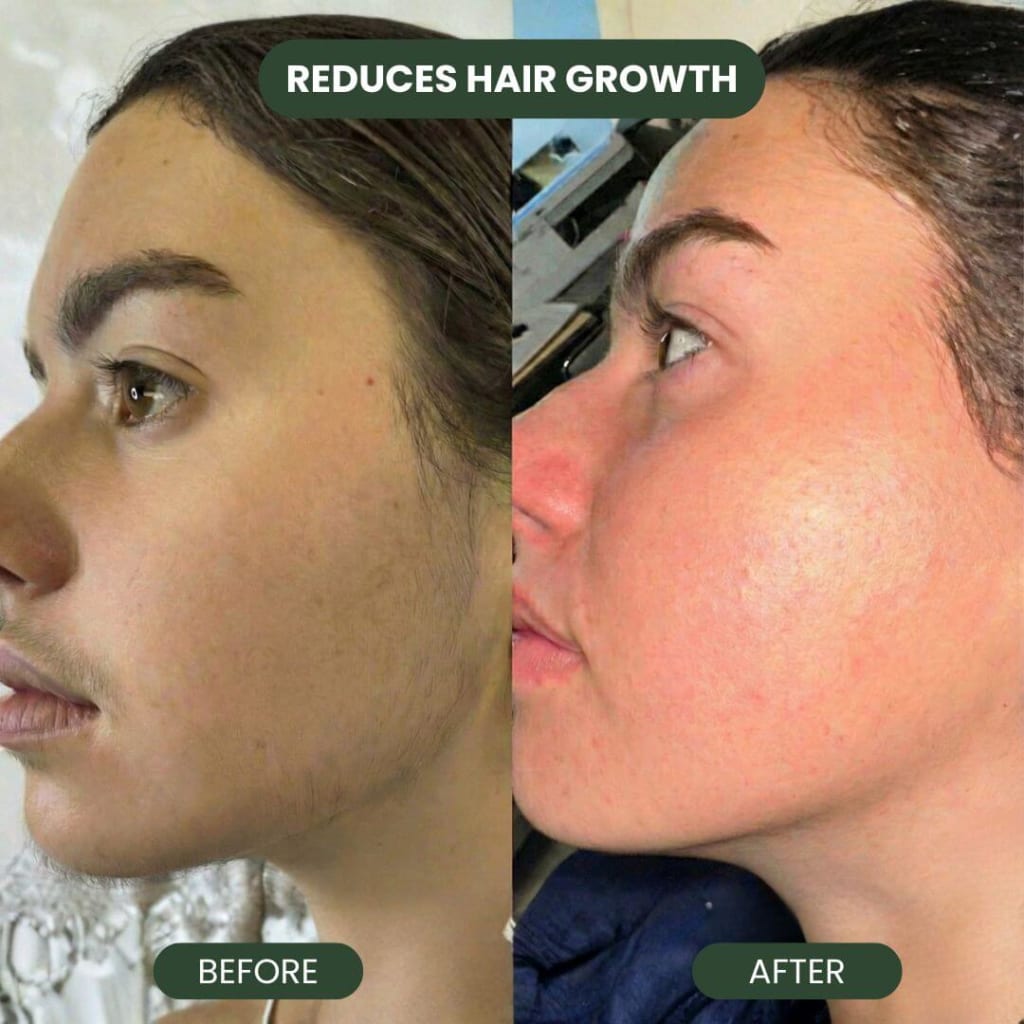 Habled Cyperus Rotundus Oil