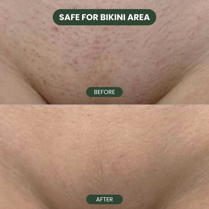 Habled Cyperus Rotundus Oil